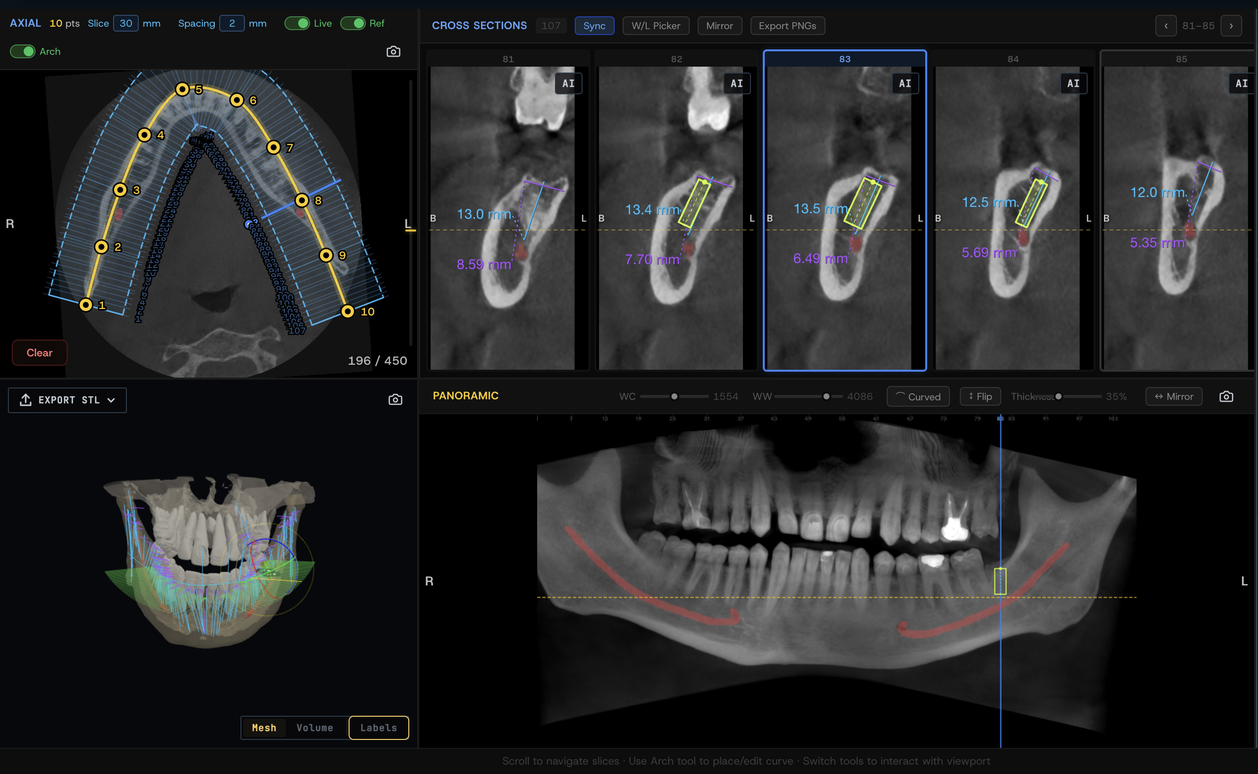 GalaxyMed Curved-MPR view — axial arch, cross-sections, panoramic reconstruction